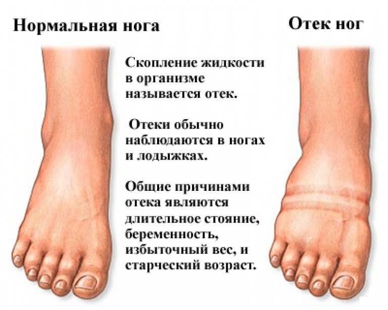 Как определить здоровые ноги: основные признаки и рекомендации
