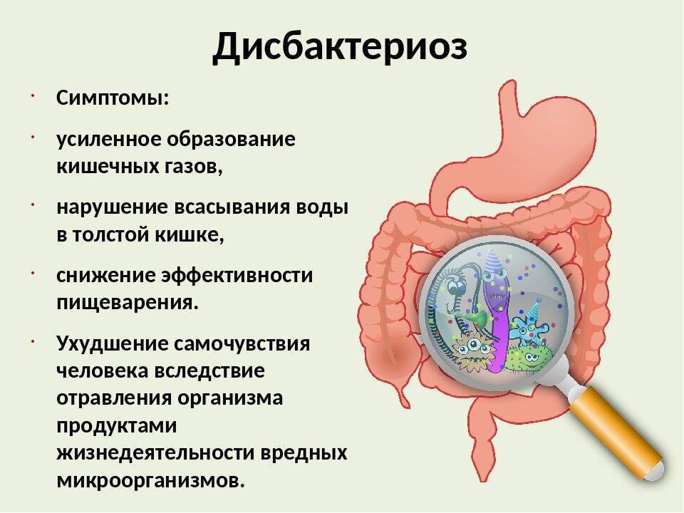 Симптомы онкологии кишечника, на что обратить внимание