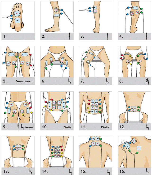 Миостимуляция живота схема наложения электродов