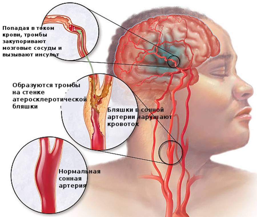 Способы диагностики сосудов головы и шеи