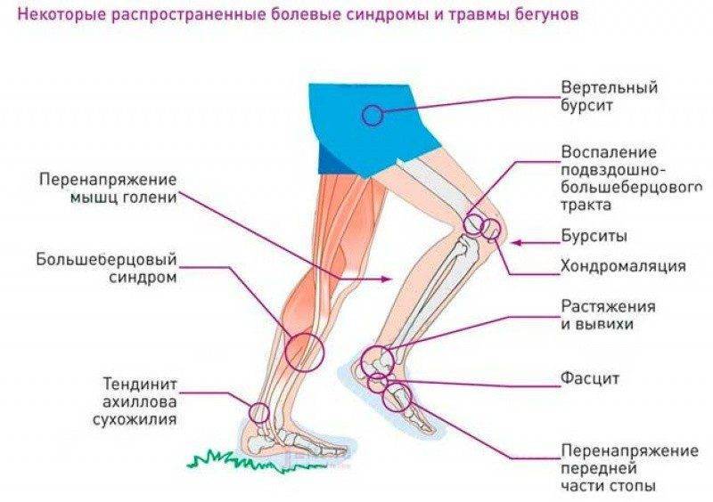 Как уберечь колени от травм: 7 проверенных способов - "марафонец"