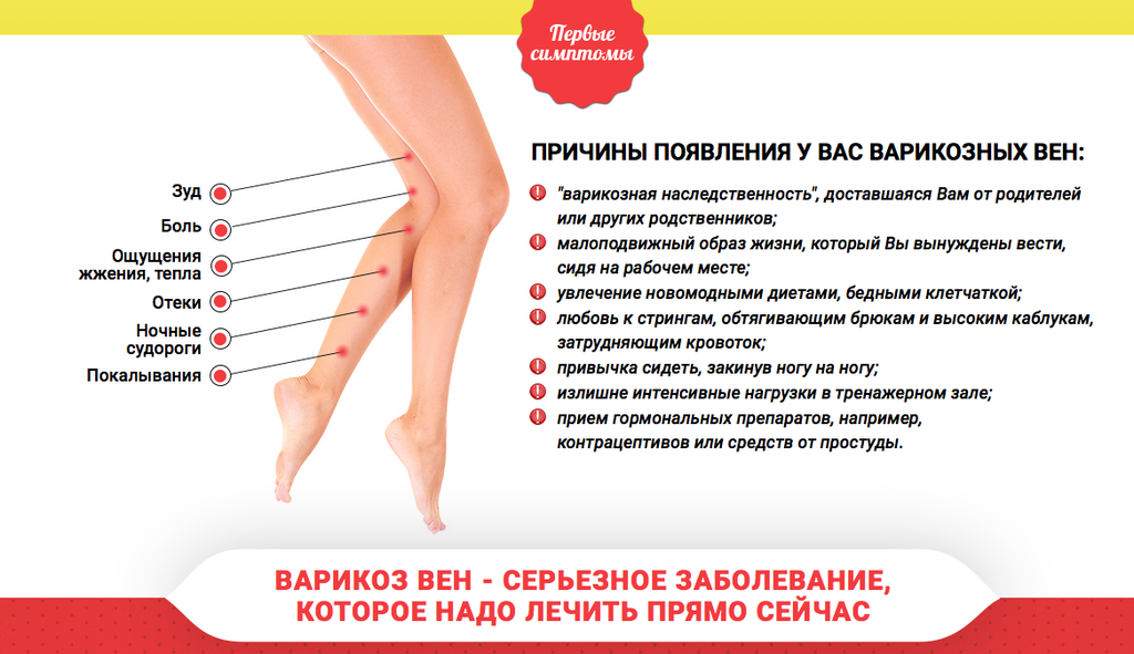 Психосоматика ног: боли, переломы, отеки и судороги