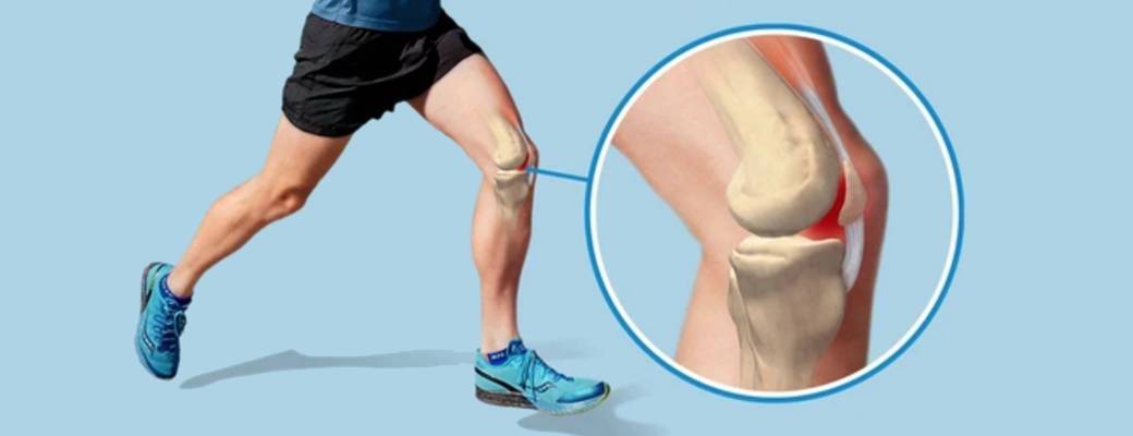 «колено бегуна»: как диагностировать, лечить и не допустить травмы - "марафонец"