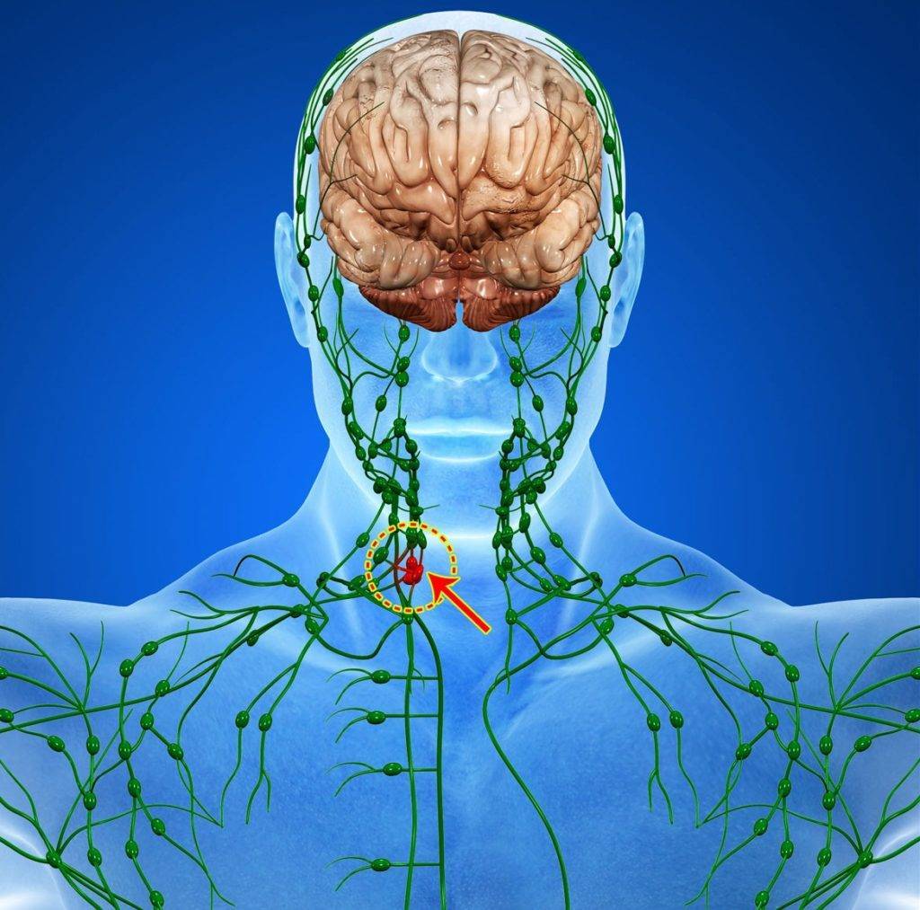 Что поможет лимфе. Лимфатическая система головного мозга. Фото лимфы человека лимфатическая система. Лимфатическая система лимфоузлы. Лимфатические сосуды мозга.